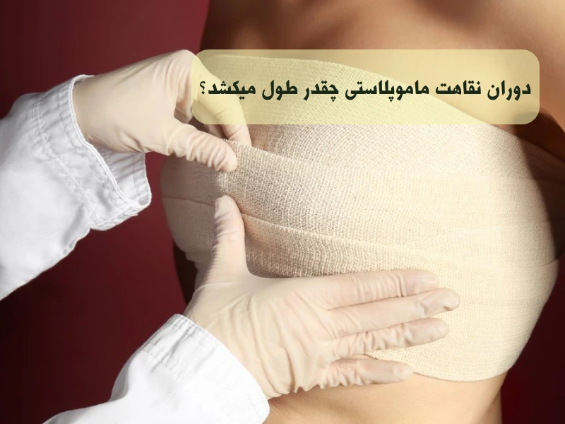 دوران نقاهت ماموپلاستی