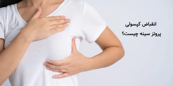 انقباض کپسولی بعد از پروتز سینه