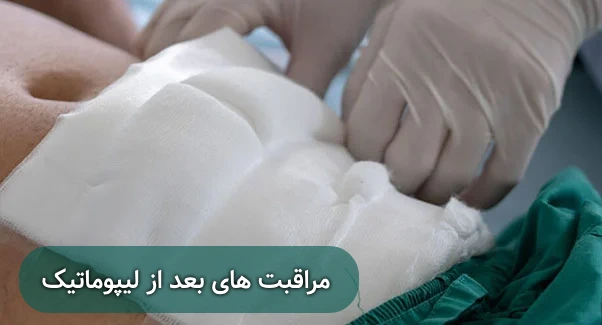 مراقبت های بعد از لیپوماتیک