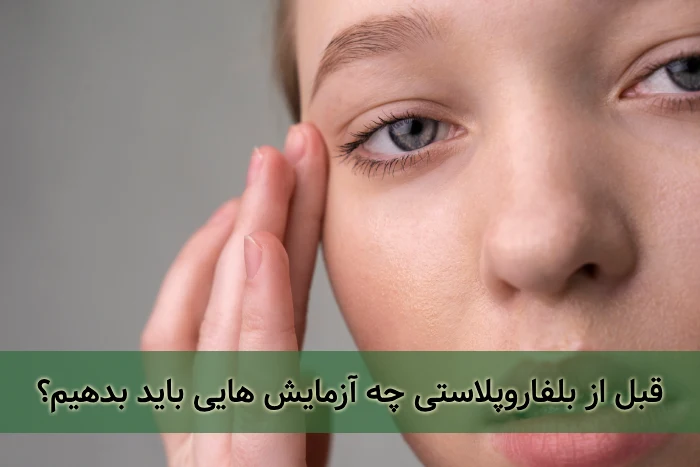 آزمایش های قبل از بلفاروپلاستی