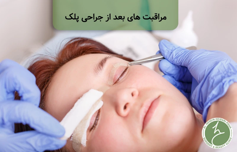 مراقبت های بعد از جراحی پلک