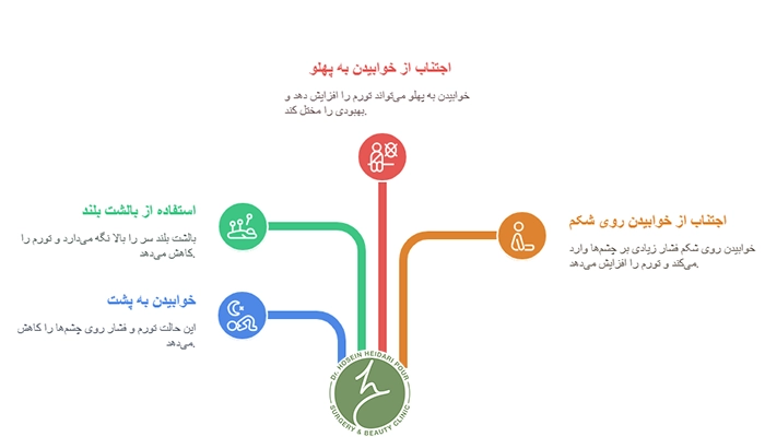 نحوه صحیح خوابیدن بعد از بلفاروپلاستی