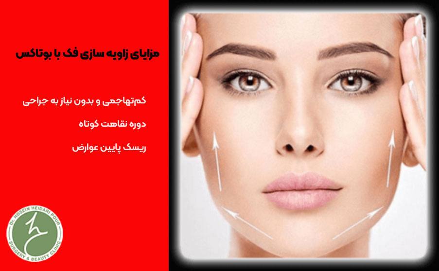 زاویه سازی صورت با بوتاکس
