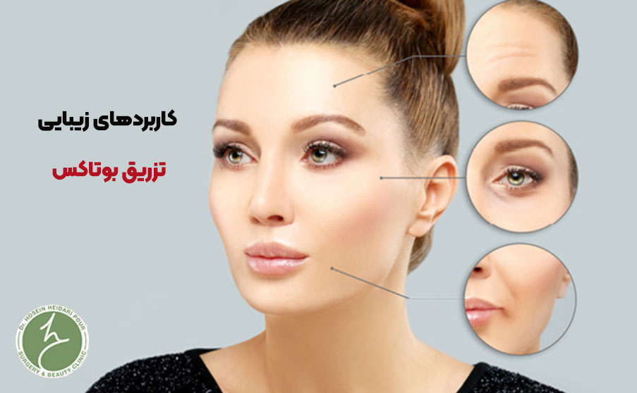 کاربردهای زیبایی نزریق بوتاکس