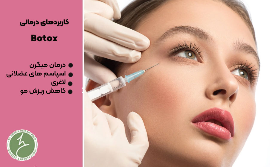 کاربردهای درمانی بوتاکس