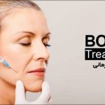 بوتاکس درمانی