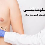 جراحی ژنیکوماستی چیست؟