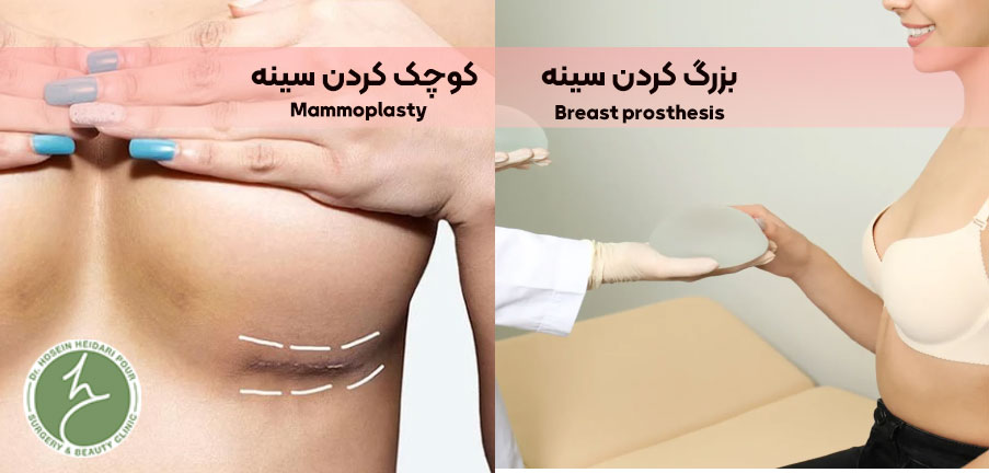 مقایسه ماموپلاستی و پروتز سینه