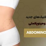 تکنیکهای جدید در ابدومینوپلاستی