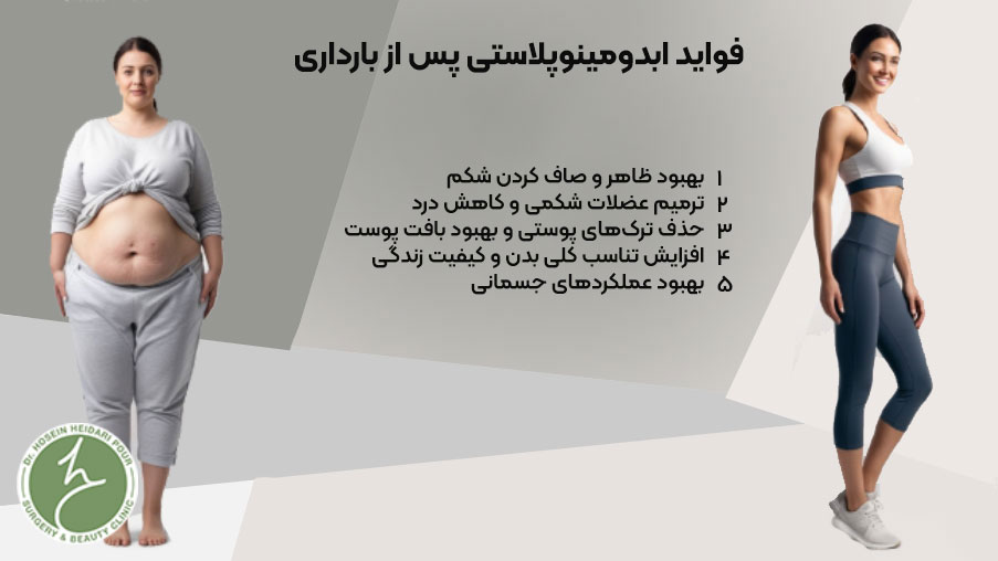 فواید ابدمینوپلاستی پس از بارداری