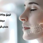 بوتاکس دندان قروچه