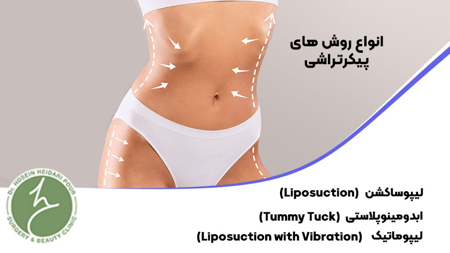 روش های جراحی پیکرتراشی
