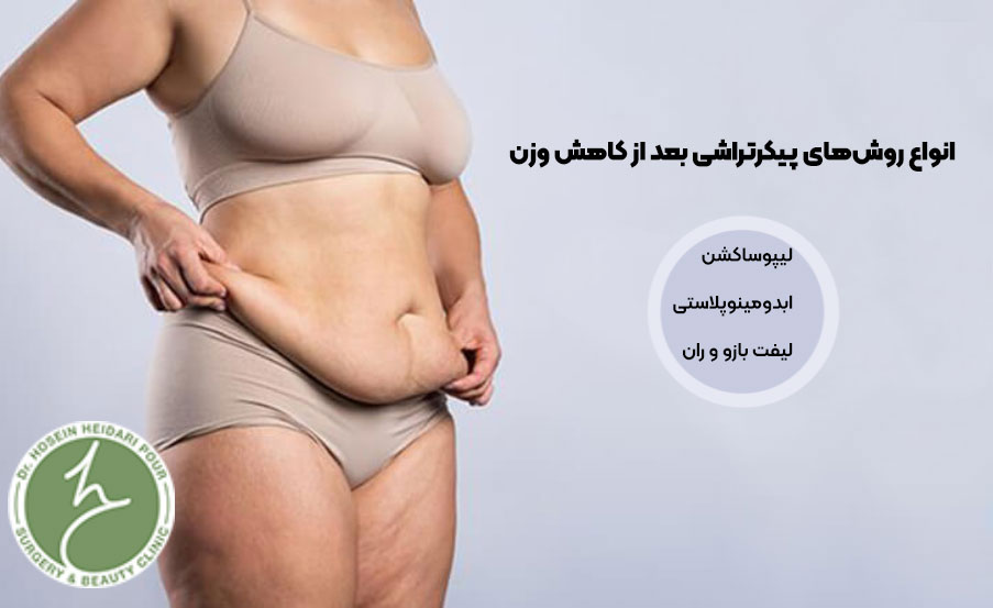 انواع روشهای پیکرتراشی
