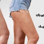 برداشتن چربی ران