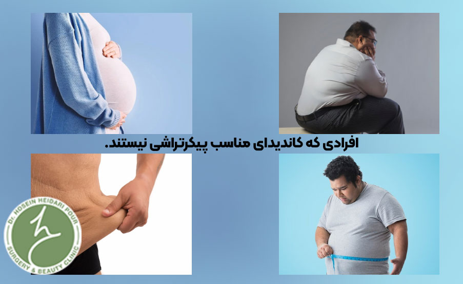 کاندیدای نامناسب پیکرتراشی