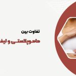 تفاوت ماموپلاستی و لیفت سینه