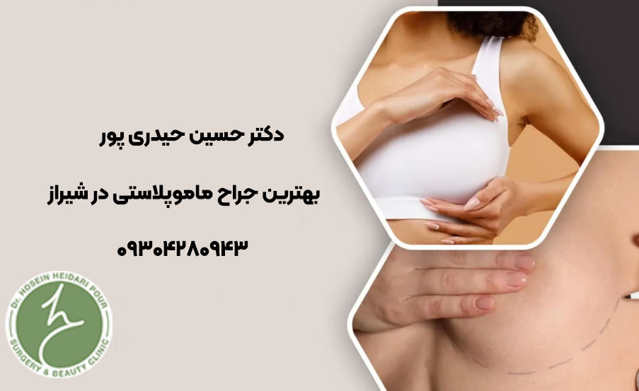بهترین جراح ماموپلاستی