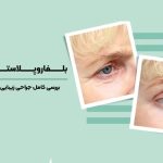 جراحی زیبایی پلک بالا و پایین