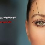 تفاوت بلفاروپلاستی پلک بالا و پایین