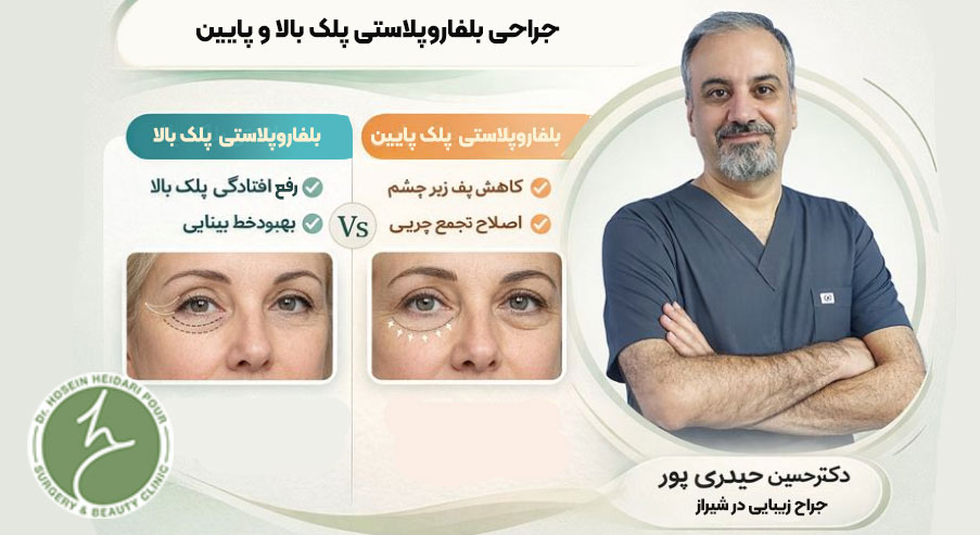بهترین جراح بلفاروپلاستی در شیراز