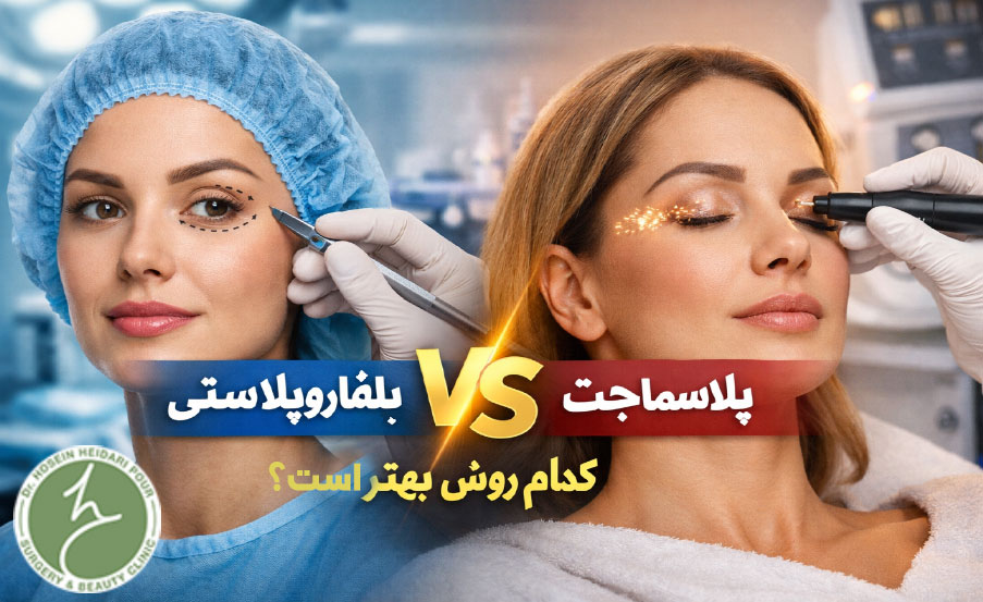 بلفاروپلاستی یا پلاسماجت