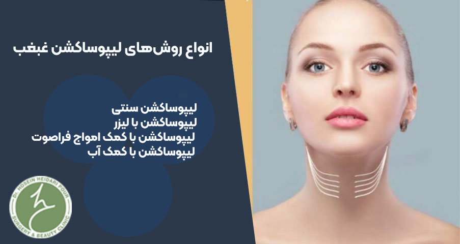 انواع لیپوساکشن غبغب