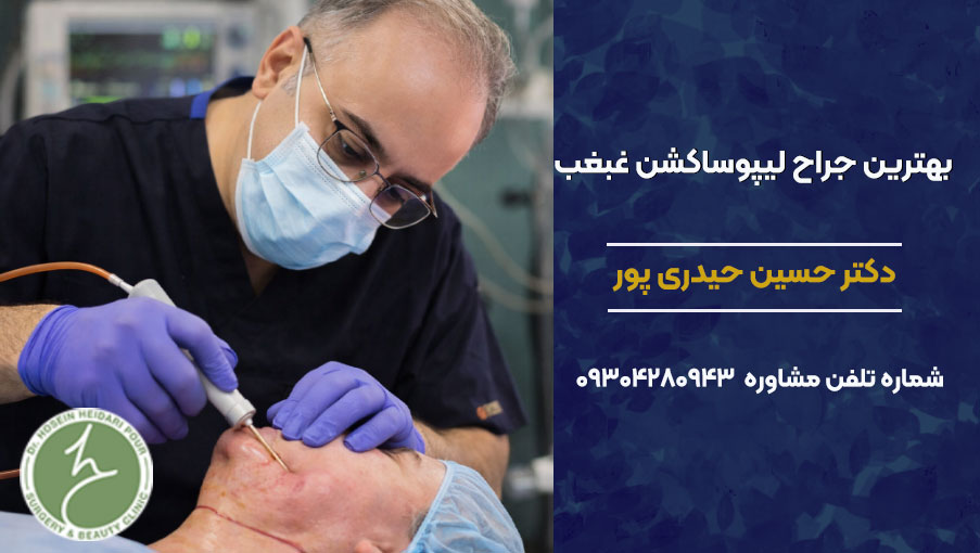 بهترین جراح برای لیپوساکشن