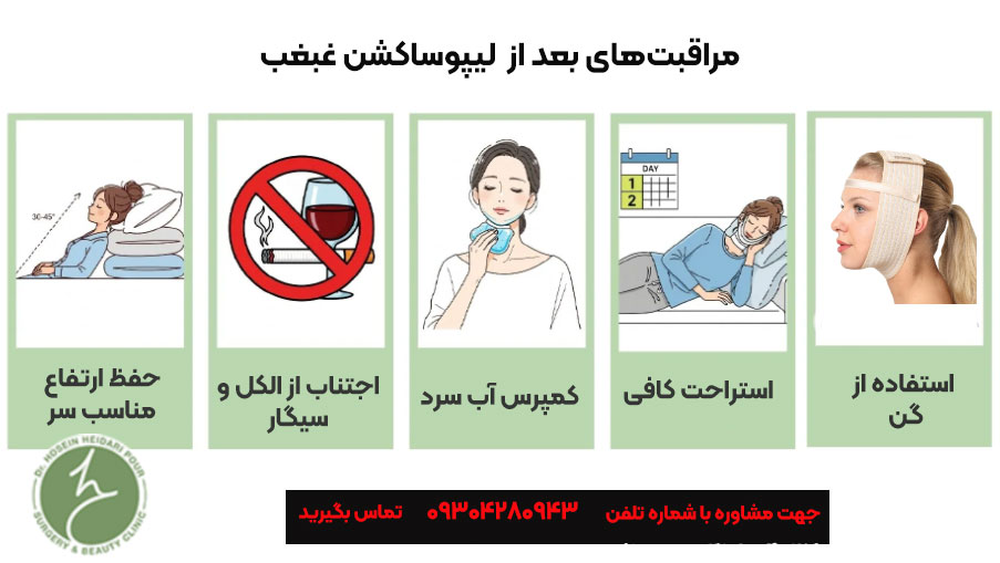 مراقبت های بعد از عمل لیپوساکشن غبغب