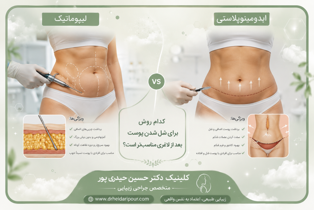 شل شدن پوست بعد از لاغری