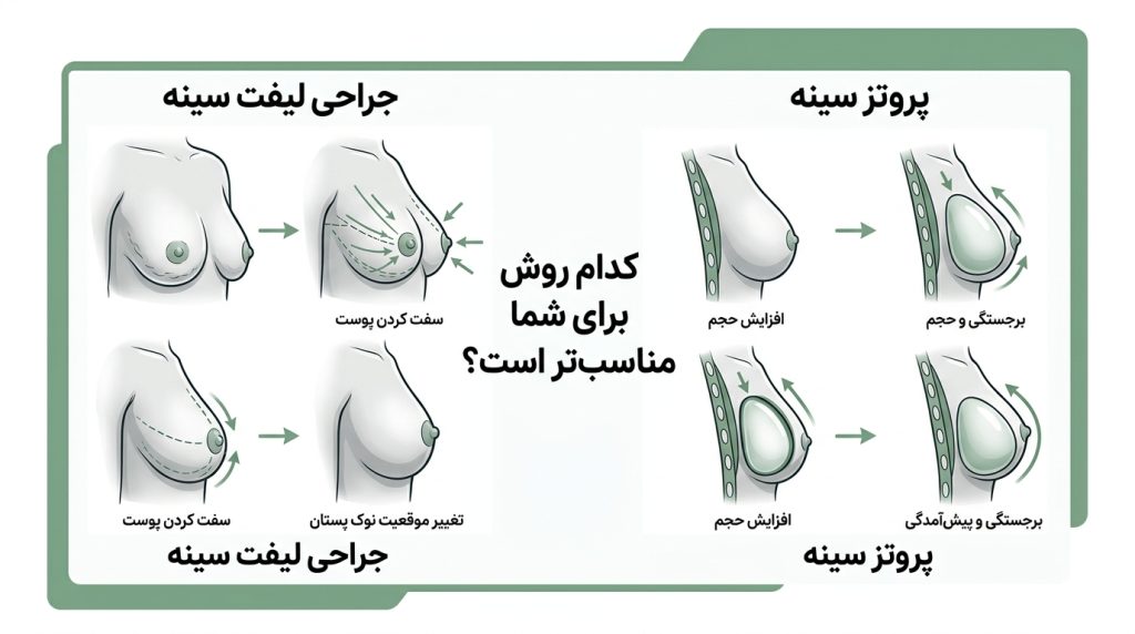 افتادگی سینه بعد از شیردهی
