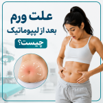 علت ورم بعد از لیپوماتیک چیست؟