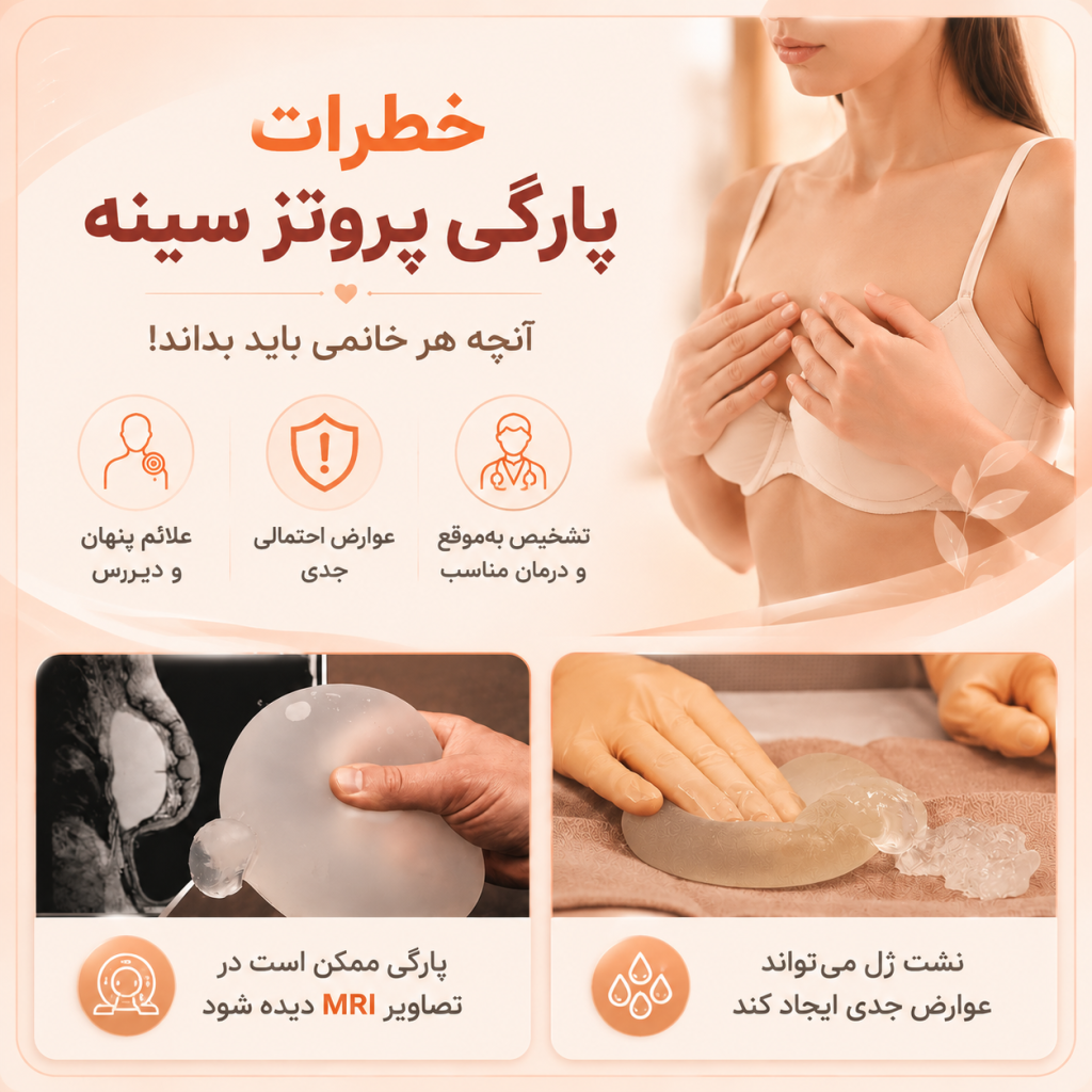 علائم پارگی پروتز سینه چیست ؟