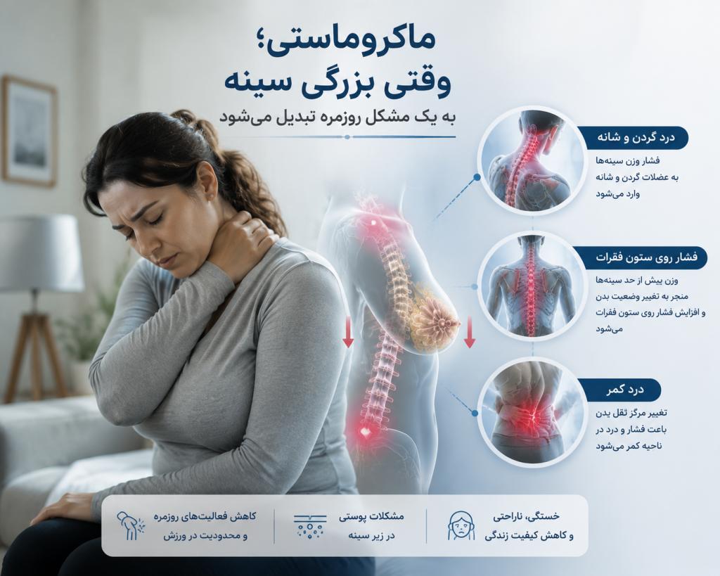ماموپلاستی کاهشی 