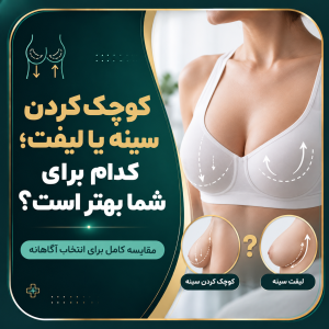کوچک کردن سینه یا لیفت سینه؛ کدام برای شما بهتر است؟
